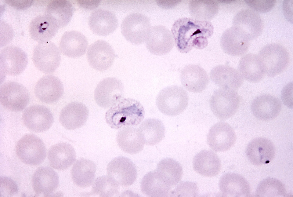 Chromatin crescent ring