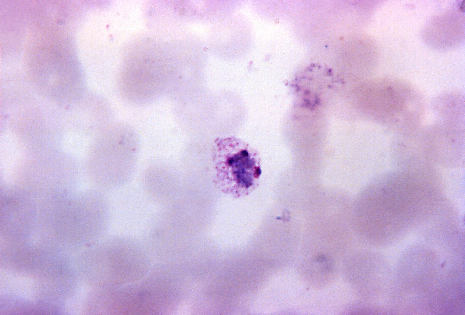 Chromatin plasmodium three