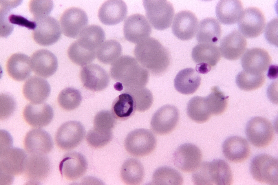 Ancient crescent plasmodium
