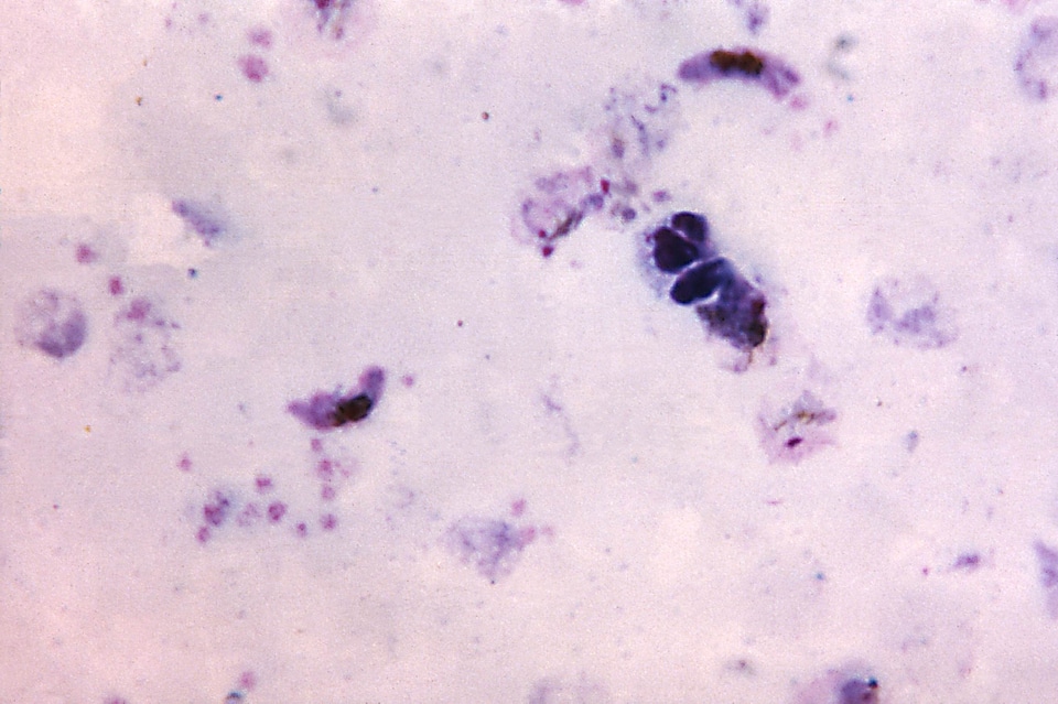 Crescent note plasmodium