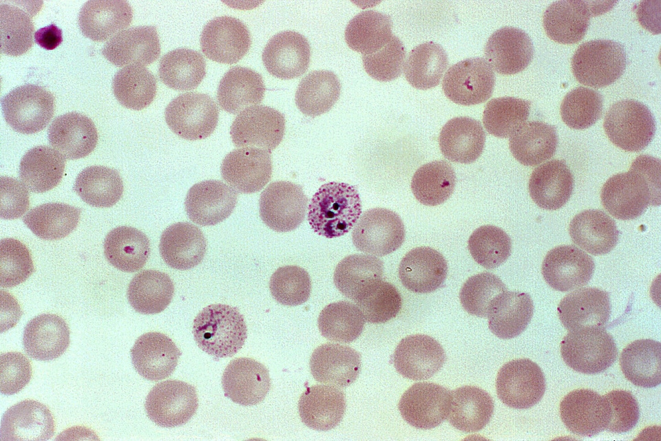 Chromatin fine found