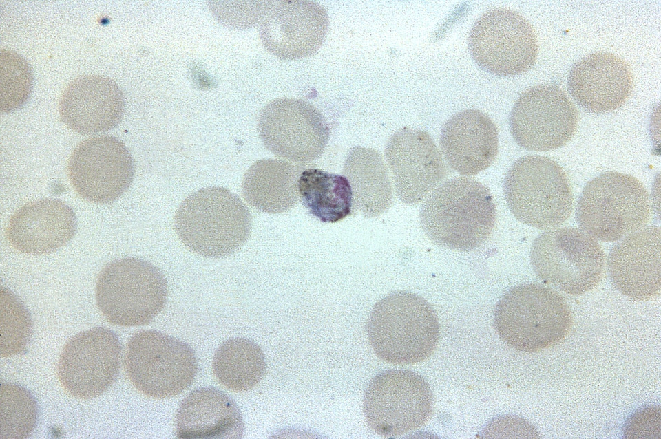 Photomicrograph plasmodium trophozoite