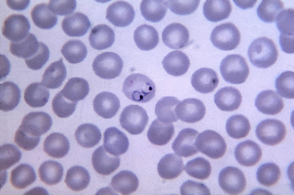 Amount chromatin cytoplasm