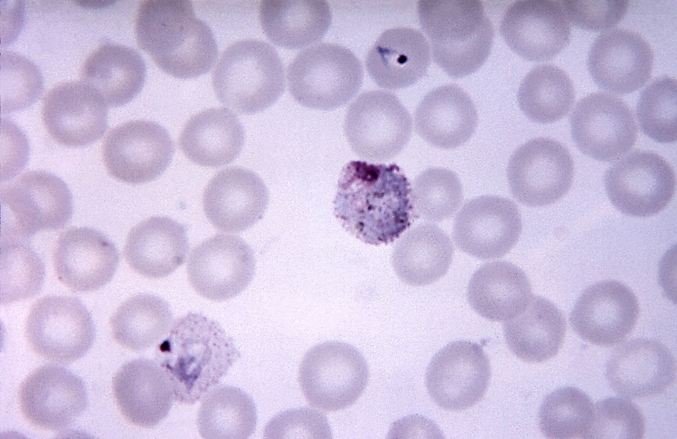 Amount brown cytoplasm
