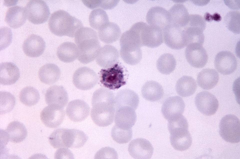 Blue cytoplasm plasmodium