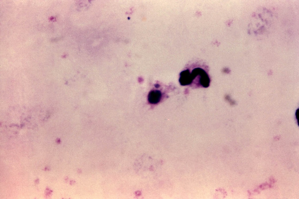 Film magnification scrub