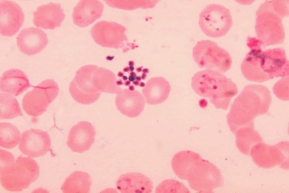Blood cervical smear found