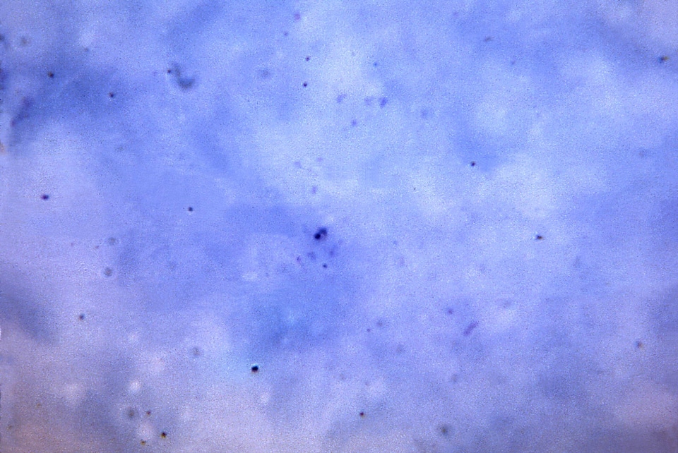 Compact form plasmodium