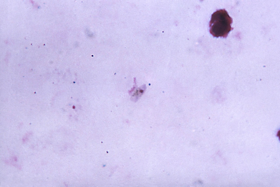 Gametocyte pink plasmodium