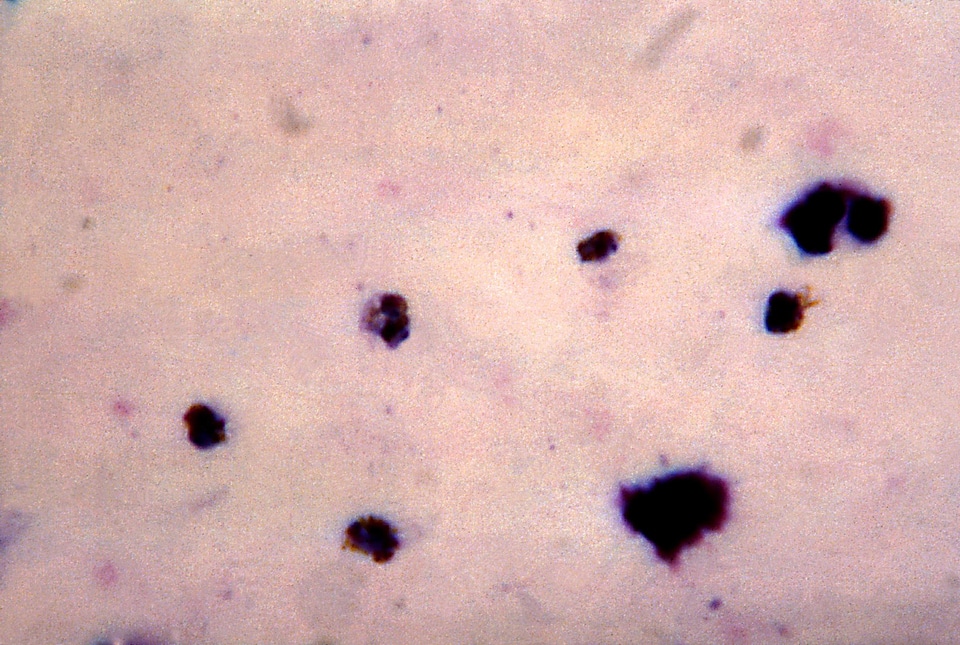 Ancient crescent plasmodium