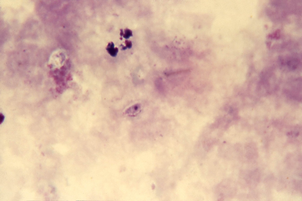 Artifact gametocyte 