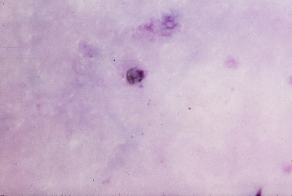 Cytoplasm light pigment