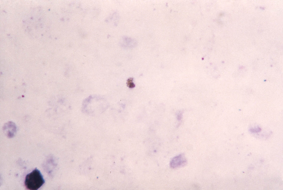 Chromatin cytoplasm gametocyte