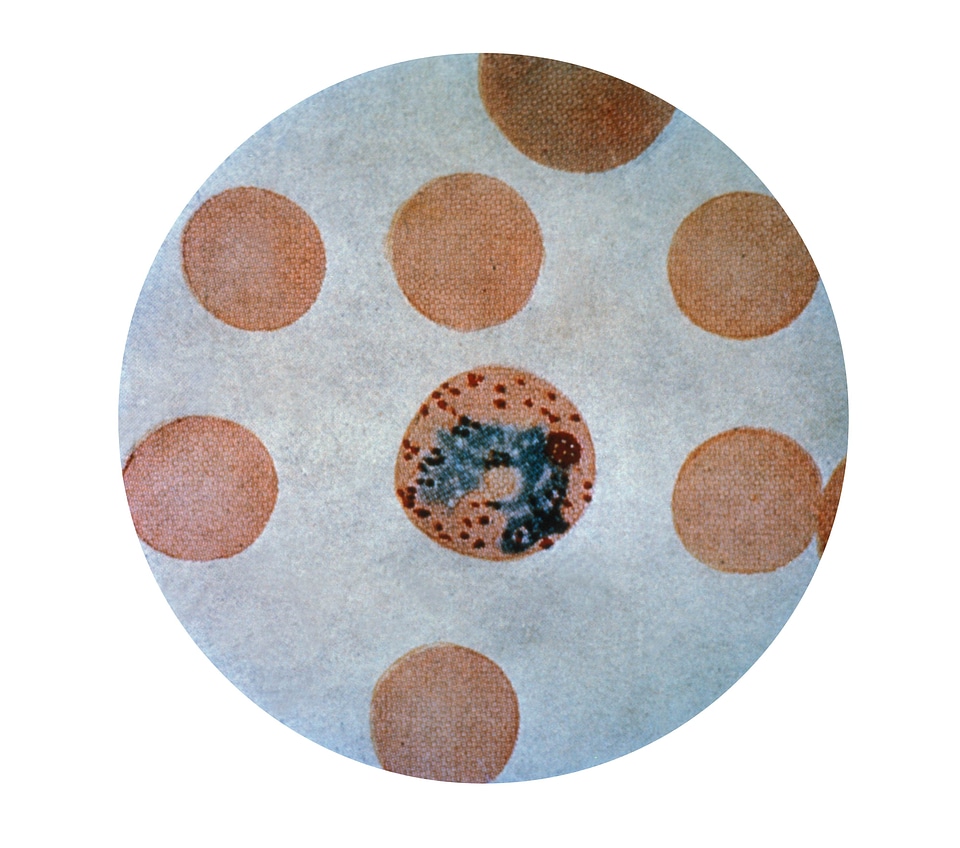 Photomicrograph plasmodium scrub