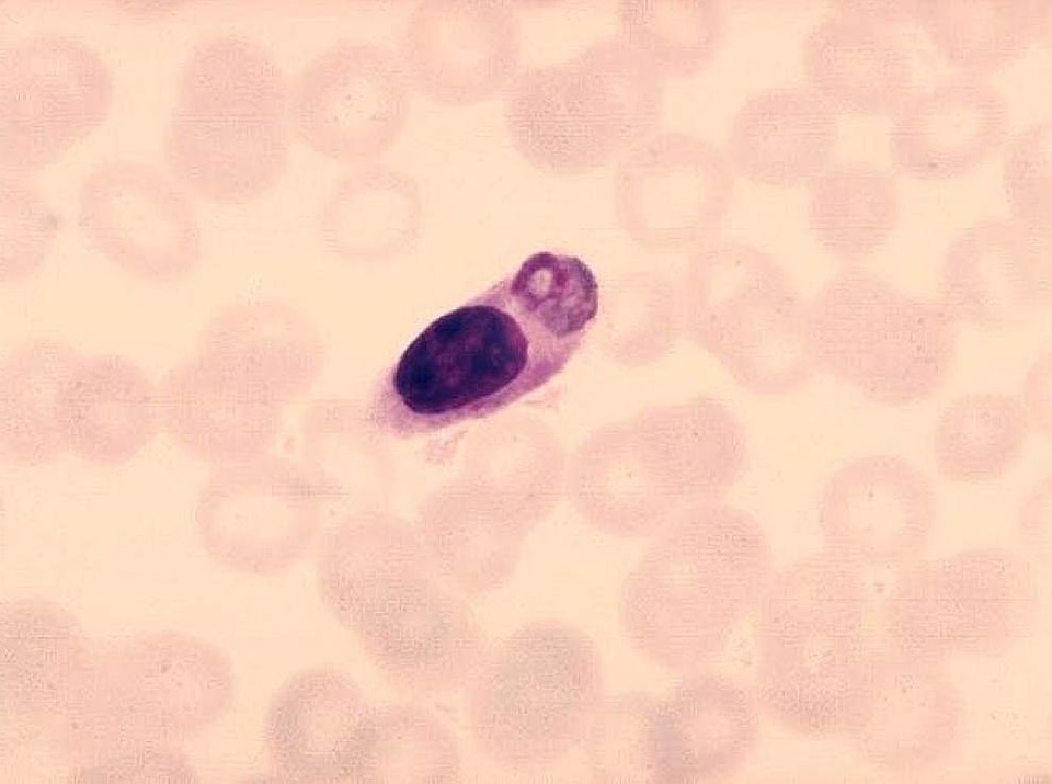 Malaria monocyte parasit
