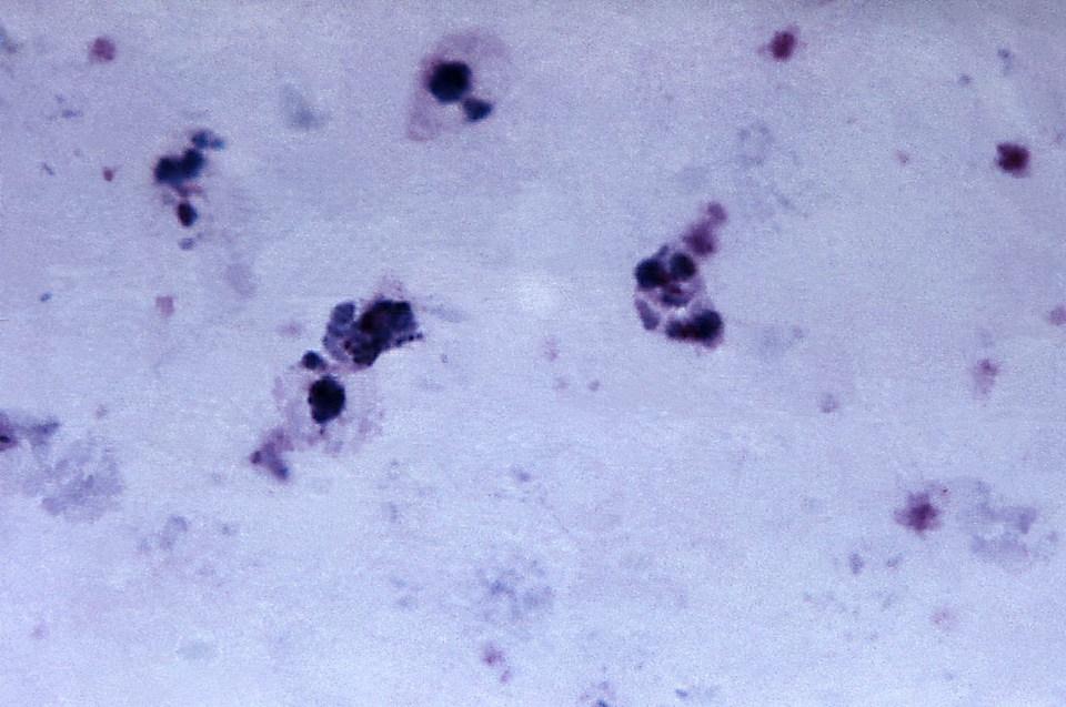 Ancient trophozoite 