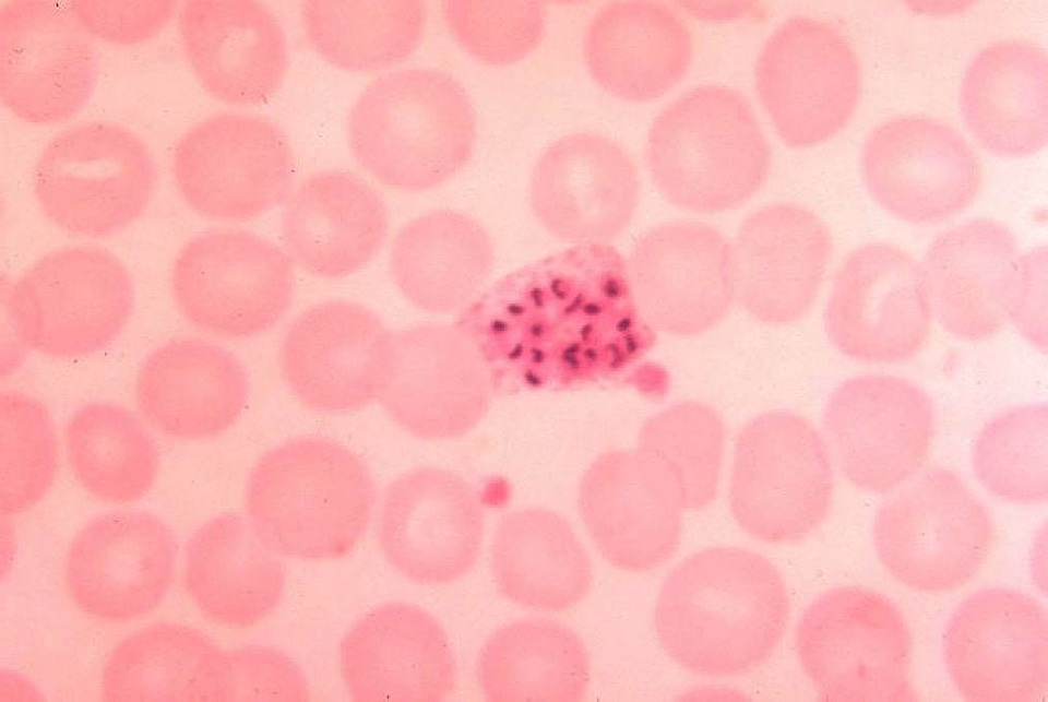 Blood cervical smear parasit
