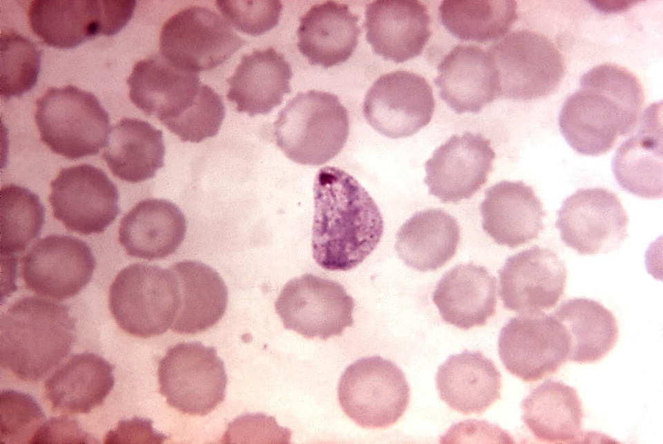 Amount cytoplasm plasmodium