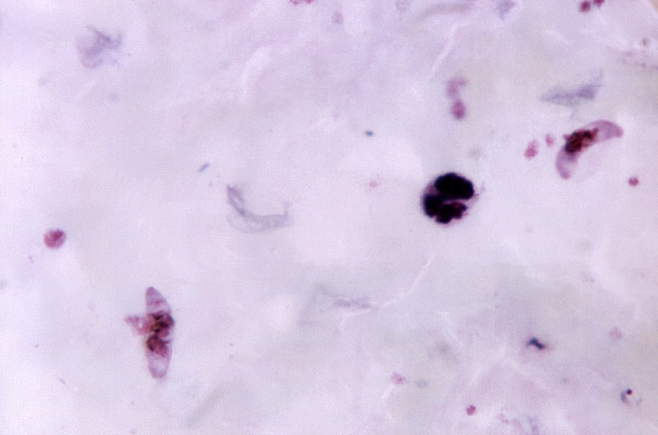 Crescent pinkish plasmodium