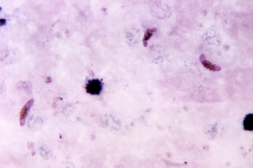 Crescent pinkish plasmodium
