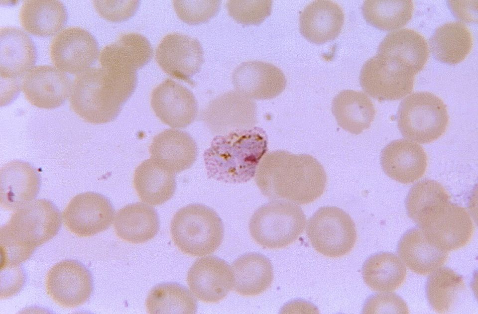 Ancient cytoplasm plasmodium