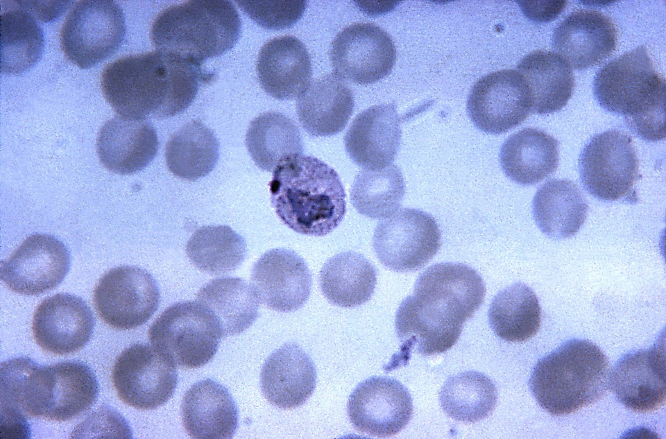 Crescent pigment trophozoite