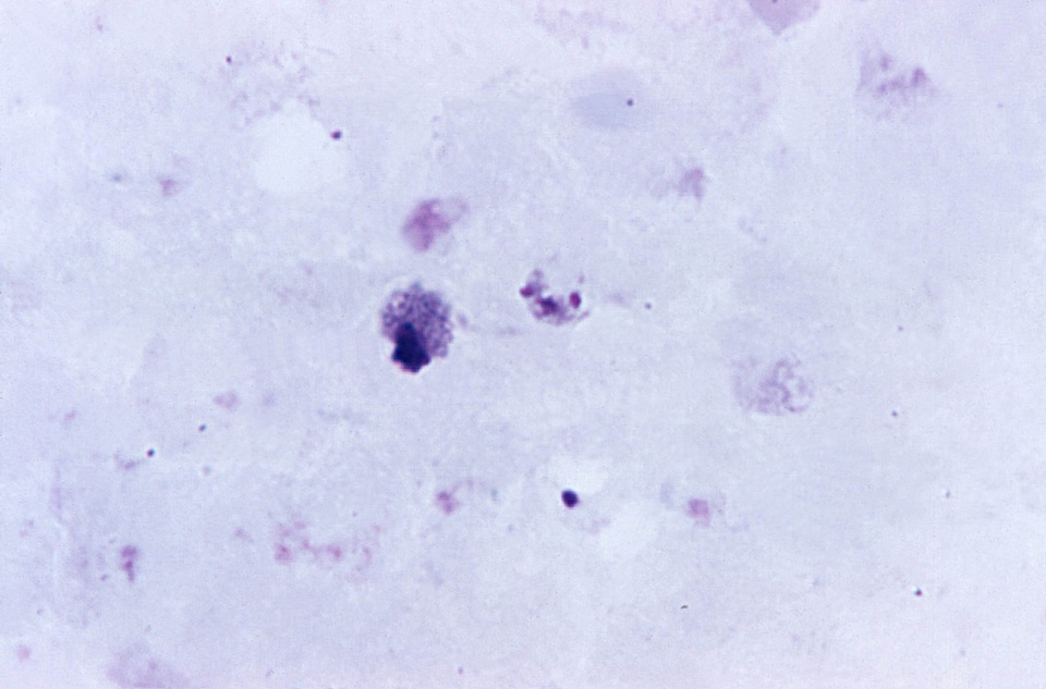 Film photomicrograph plasmodium photo