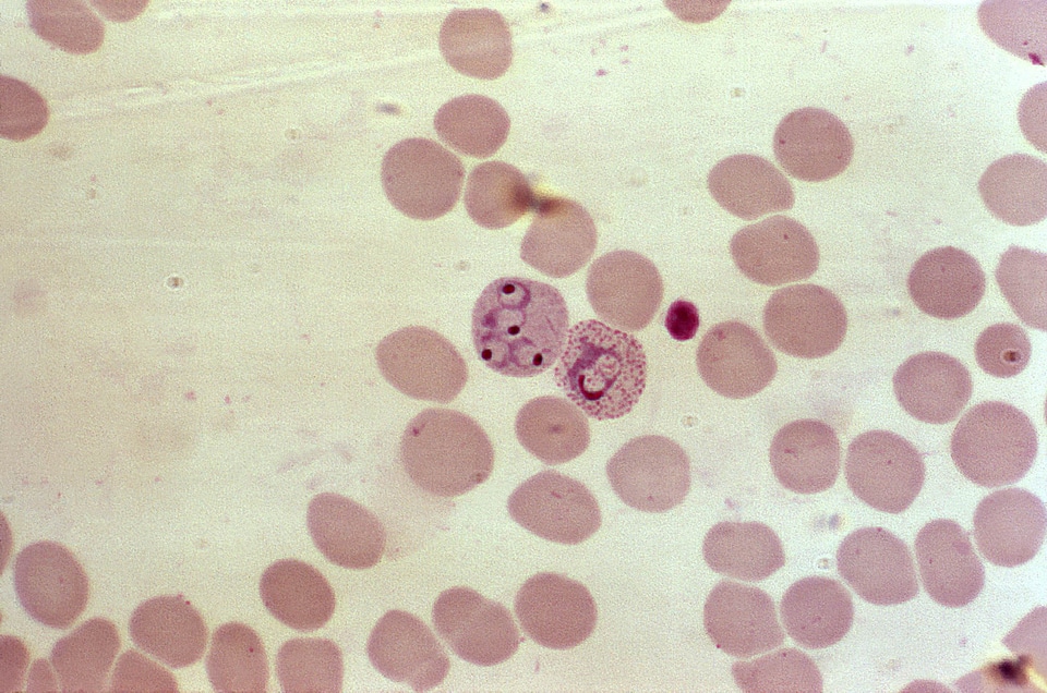 Blood cell crescent