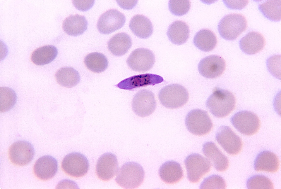 Blood cervical smear scrub