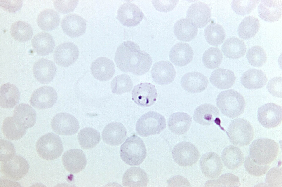 Blood coloration found
