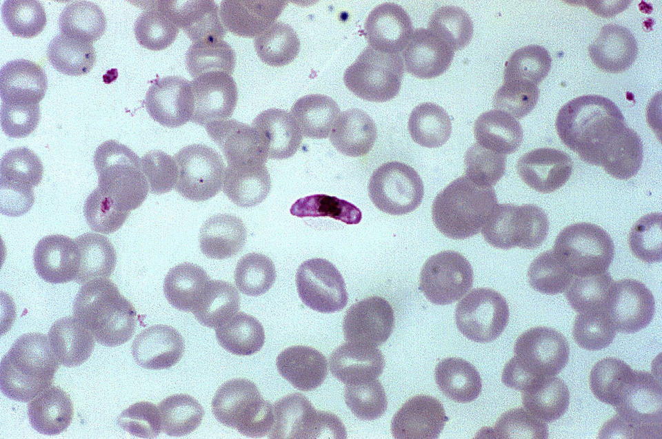 Female male mosquito