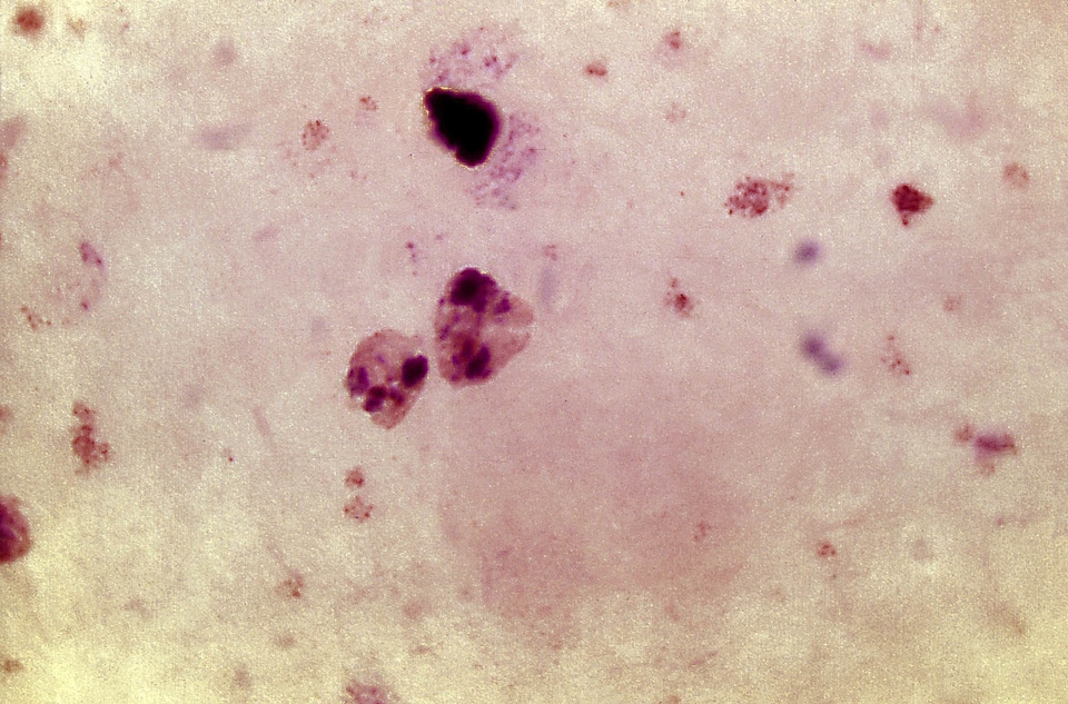 Parasit plasmodium scrub