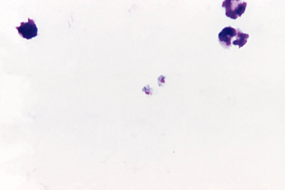 Crescent plasmodium scrub