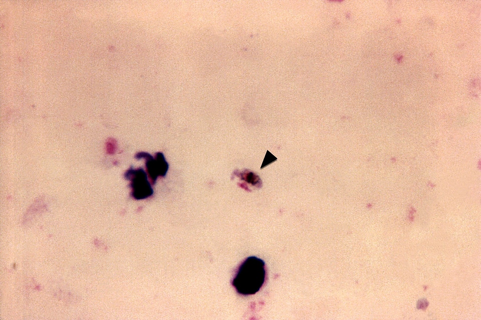 Arrow film gametocyte