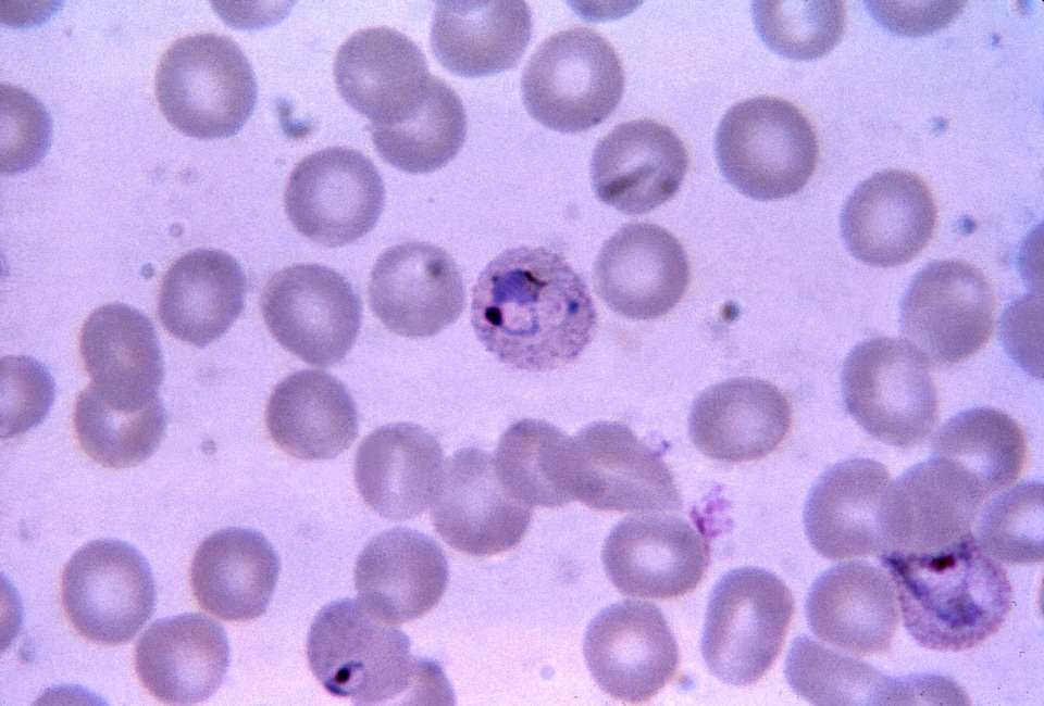 Crescent plasmodium teen