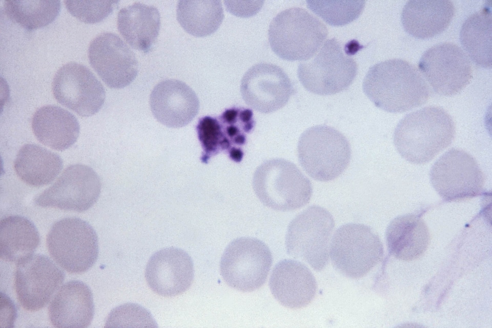 Artifact malaria parasit