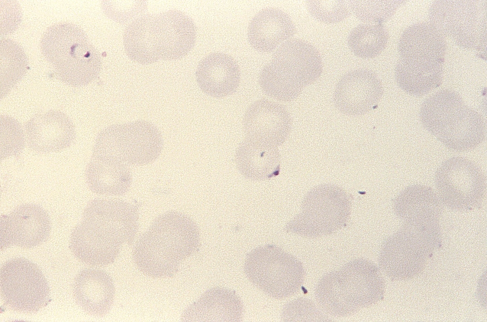 Blood cervical smear form
