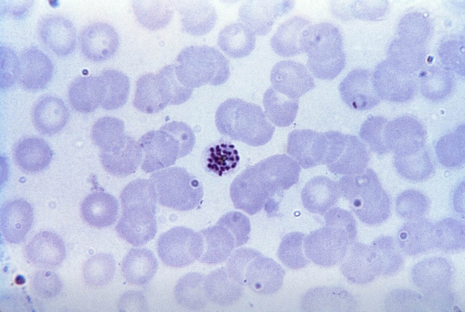 Fine intermediate plasmodium