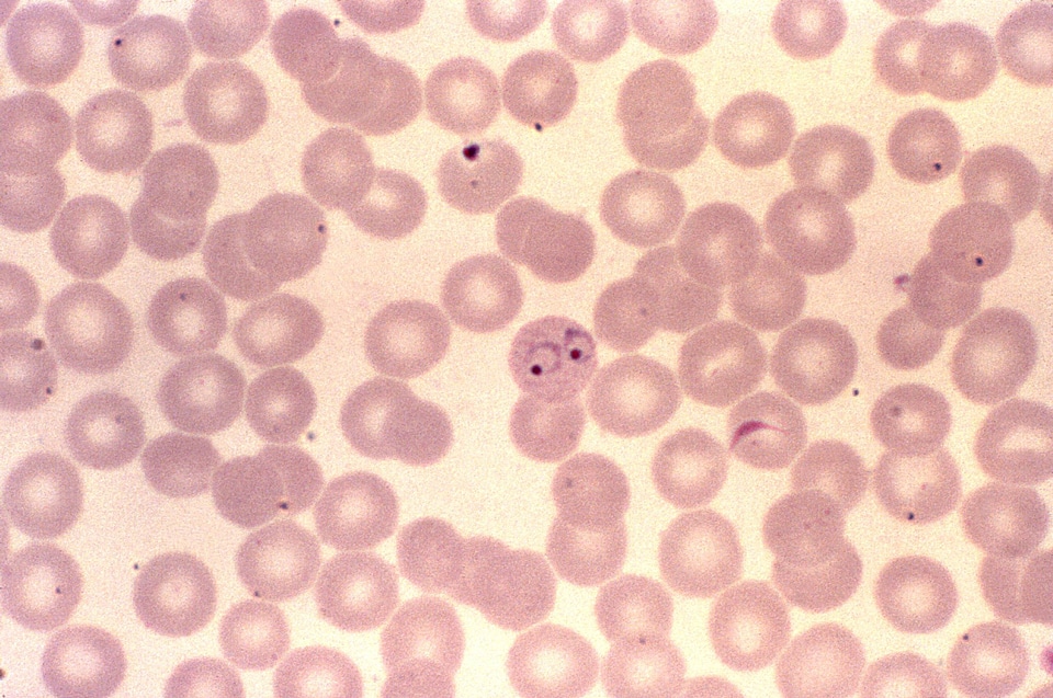 Form plasmodium ring