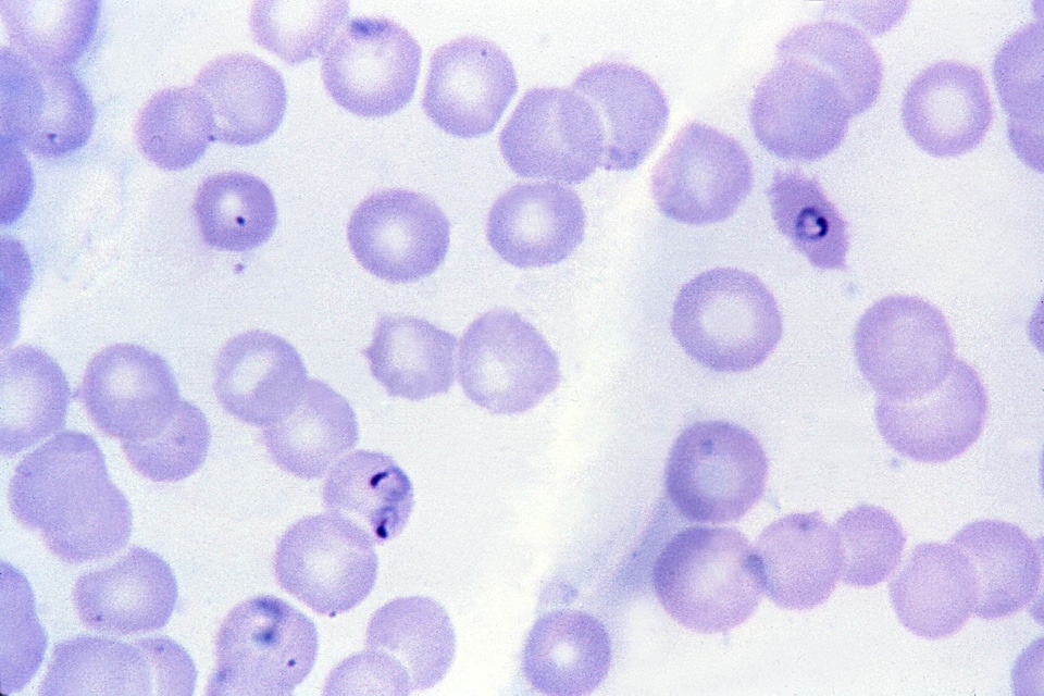 Form ring trophozoite