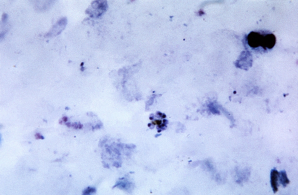 Blood cervical smear plasmodium