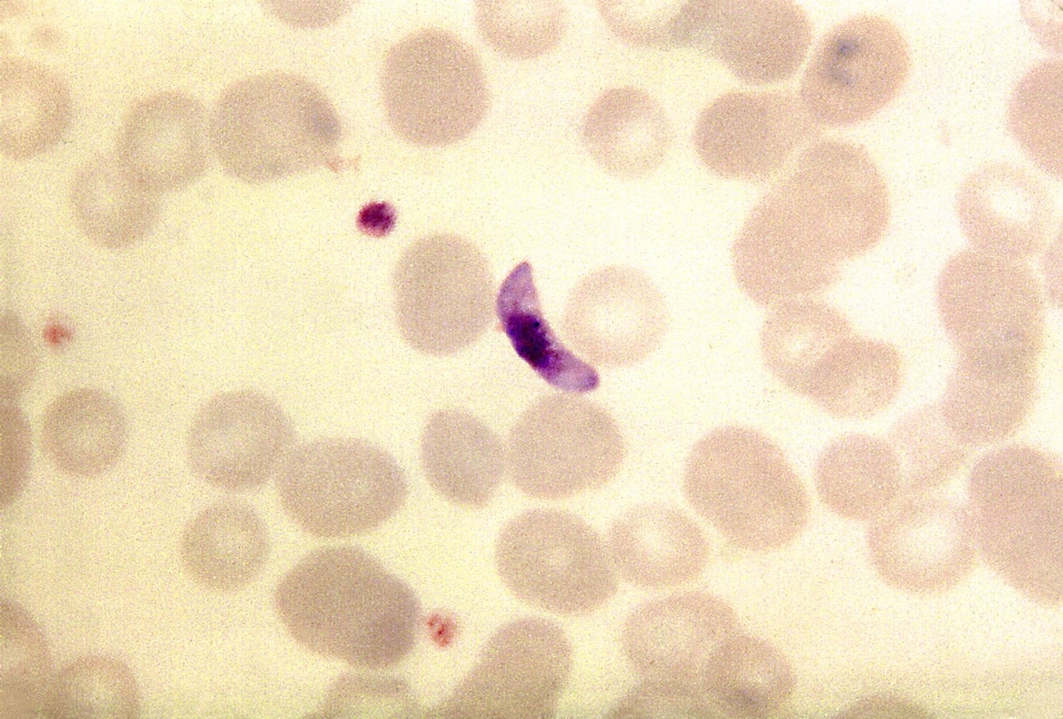 Blood cervical smear parasit