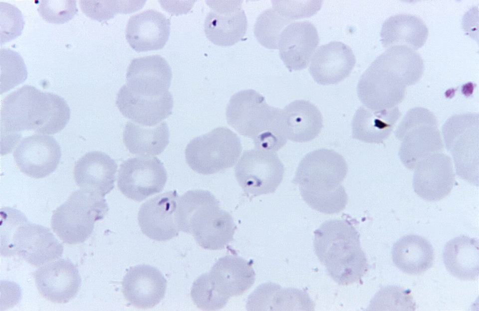 Blood cervical smear form