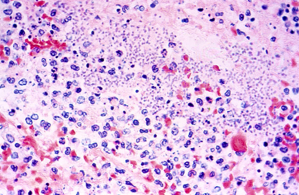 Lung photomicrograph tissue