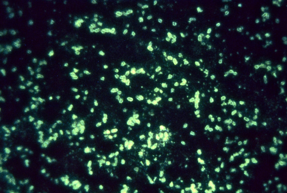 Antibody antigen antiserum