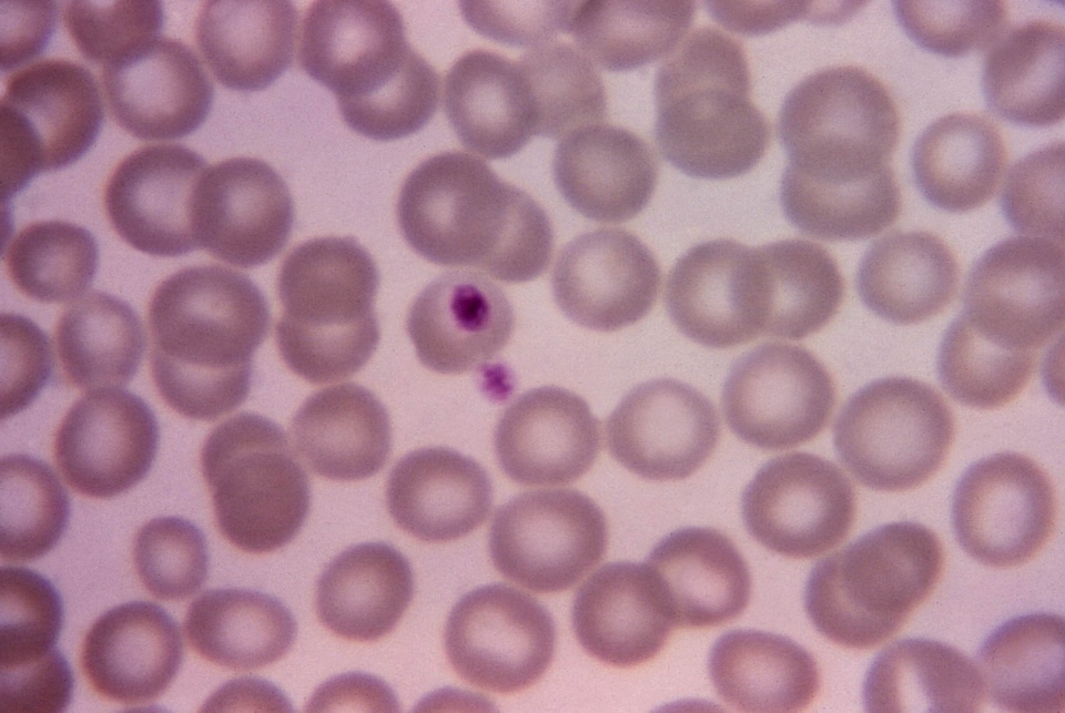 Evening plasmodium scrub