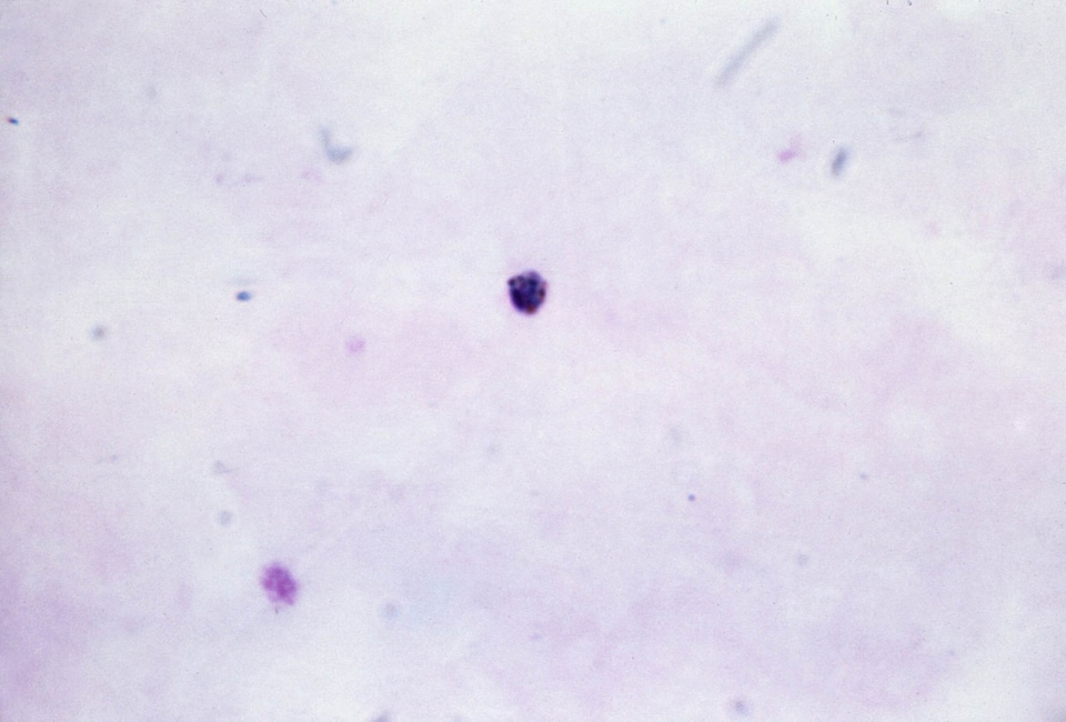 Crescent gametocyte plasmodium