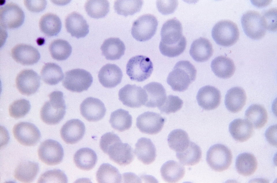 Chromatin cytoplasm rings