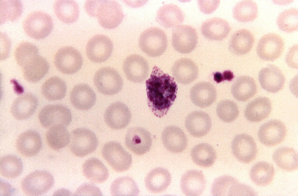 Chromatin compact cytoplasm