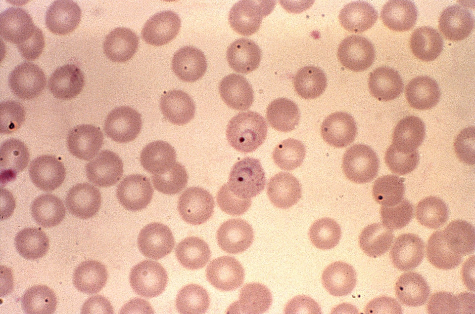 Chromatin cytoplasm plasmodium